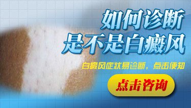 白癜风是遗传造成的吗