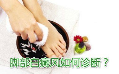 皮肤为什么会长白癜风